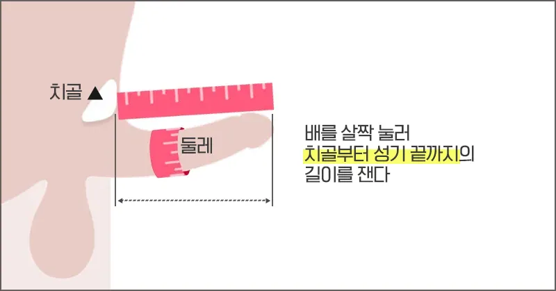 배를 살짝 눌러 치골부터 성기 끝까지 길이를 재는 방법을 설명한 측정법 이미지